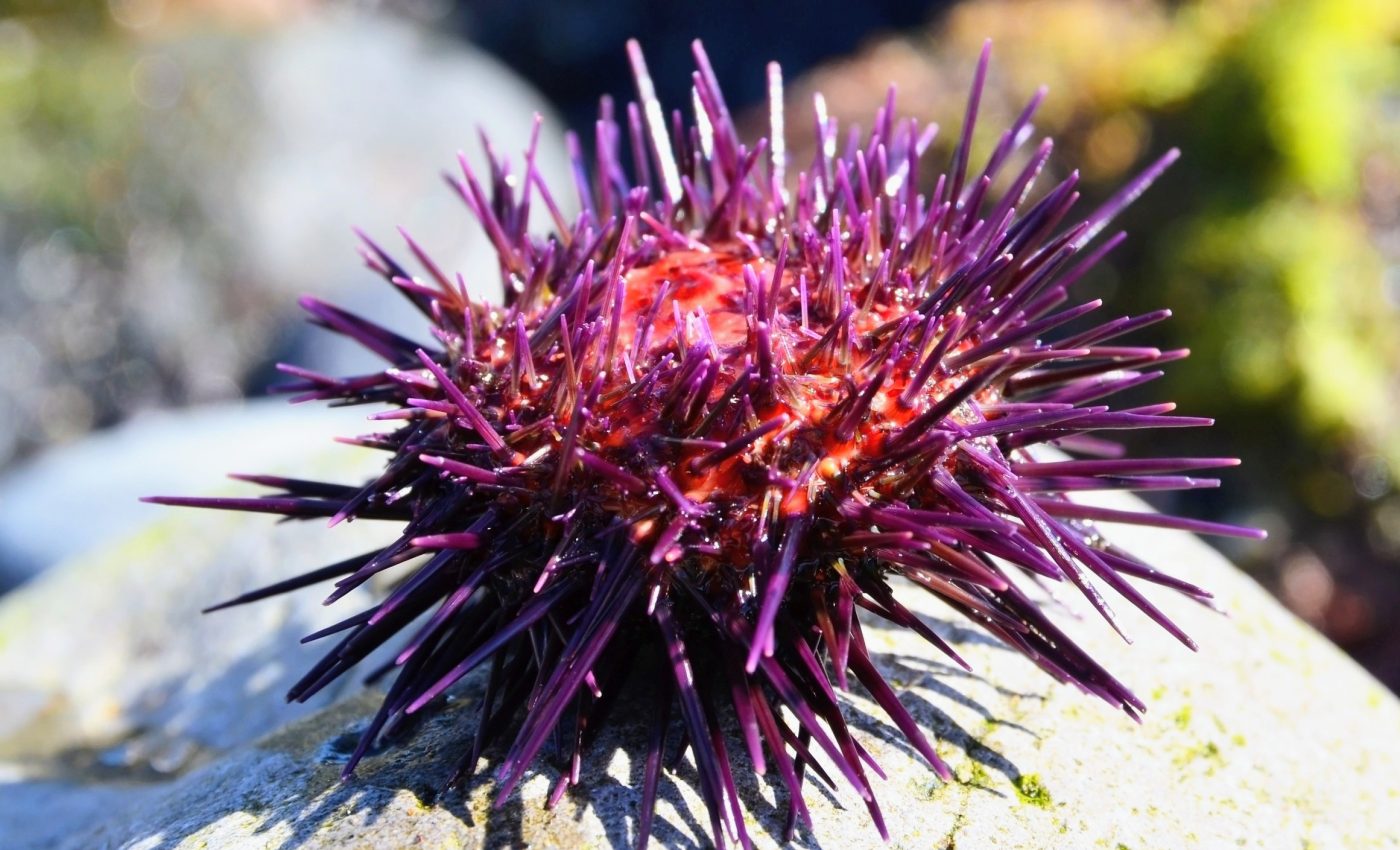 Sea urchins don’t have a brain - so they became one