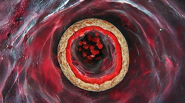 Cutting-edge tech captures images inside human heart arteries, revolutionizing medical science