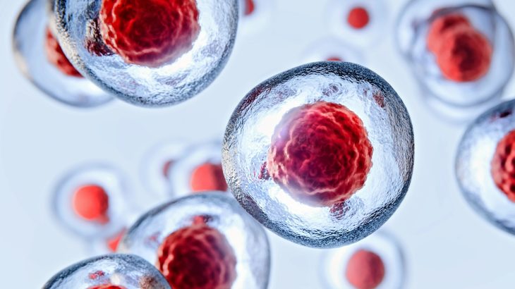 Man remains HIV-free for six years after stem cell transplant