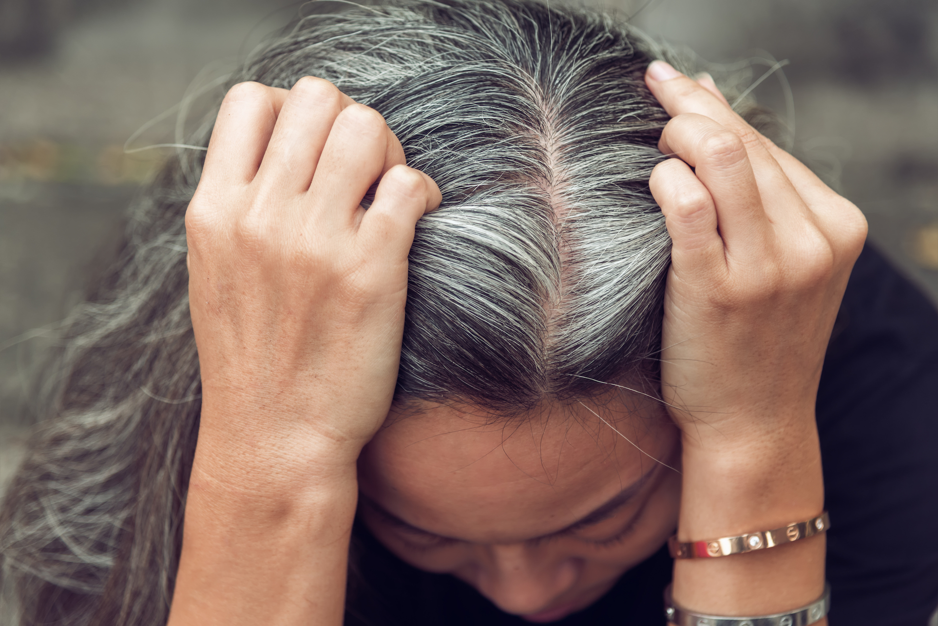 Study reveals that stress actually does cause gray hair