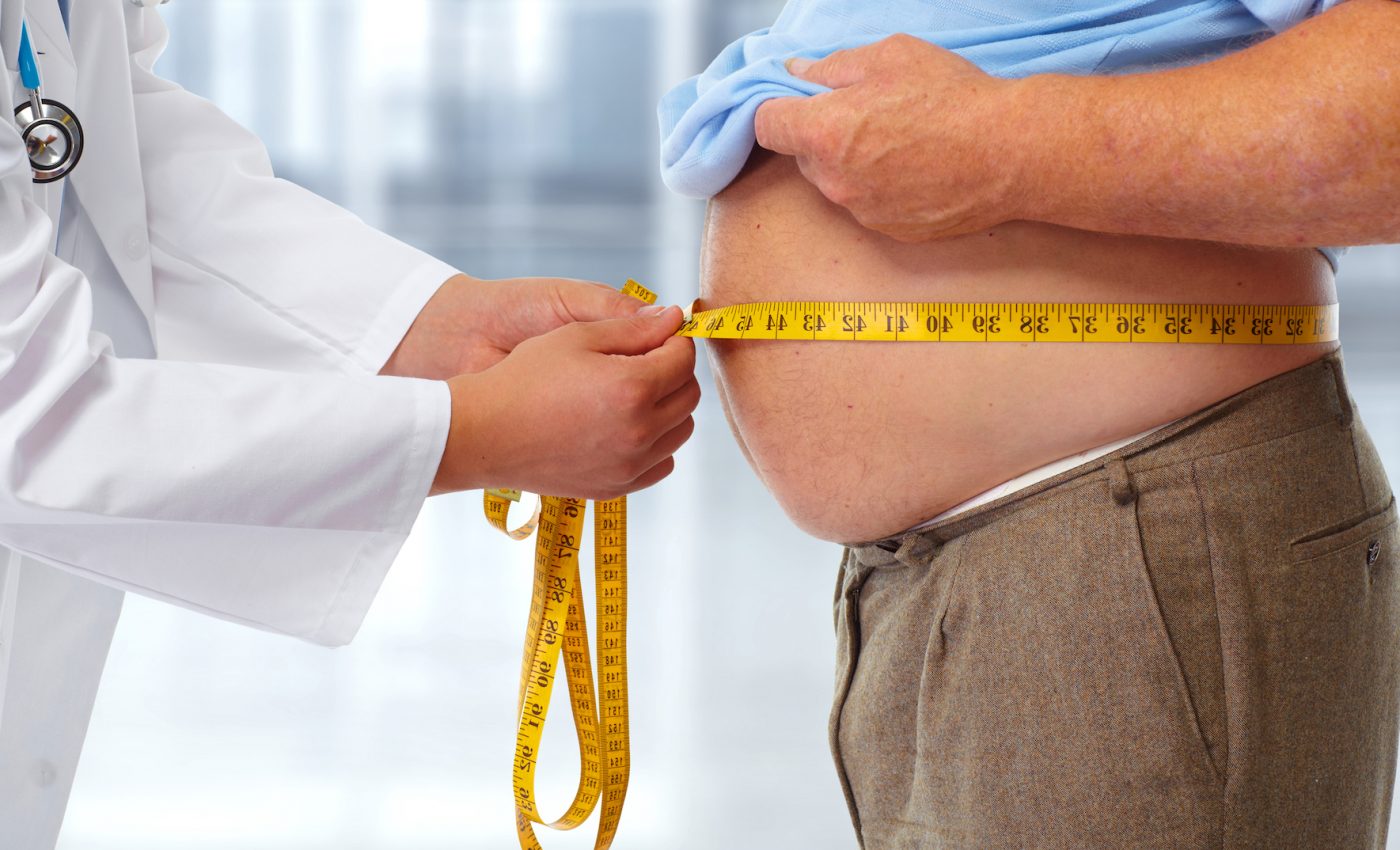 Study: Societal changes are needed to battle obesity epidemic
