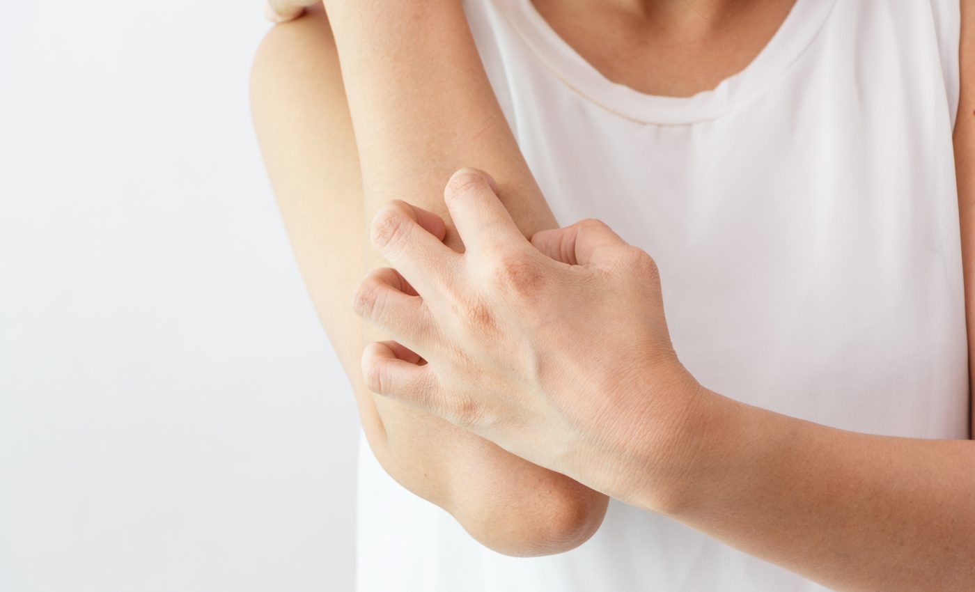 Light treatment could relieve itchy skin