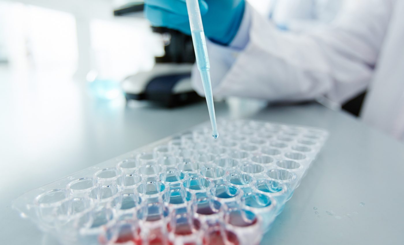 Report: EPA leadership stalled testing for chemical health risks