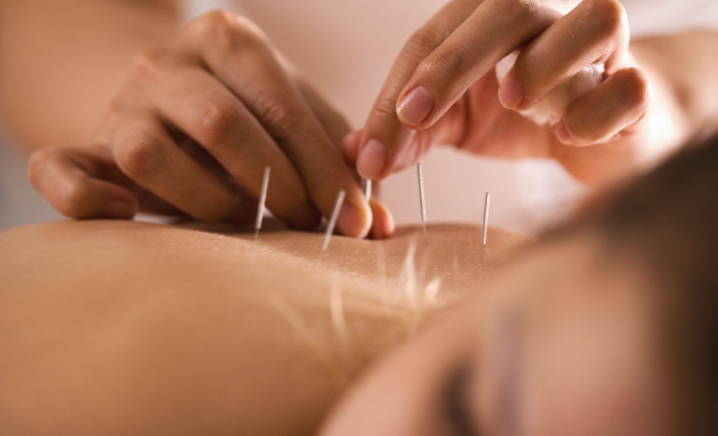 Acupuncture found to effectively ease symptoms of menopause