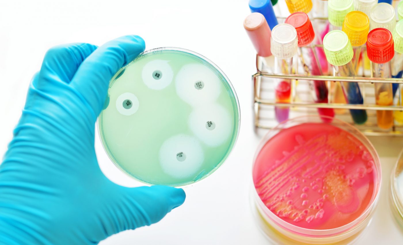 Experts have mapped levels of antimicrobial resistance worldwide