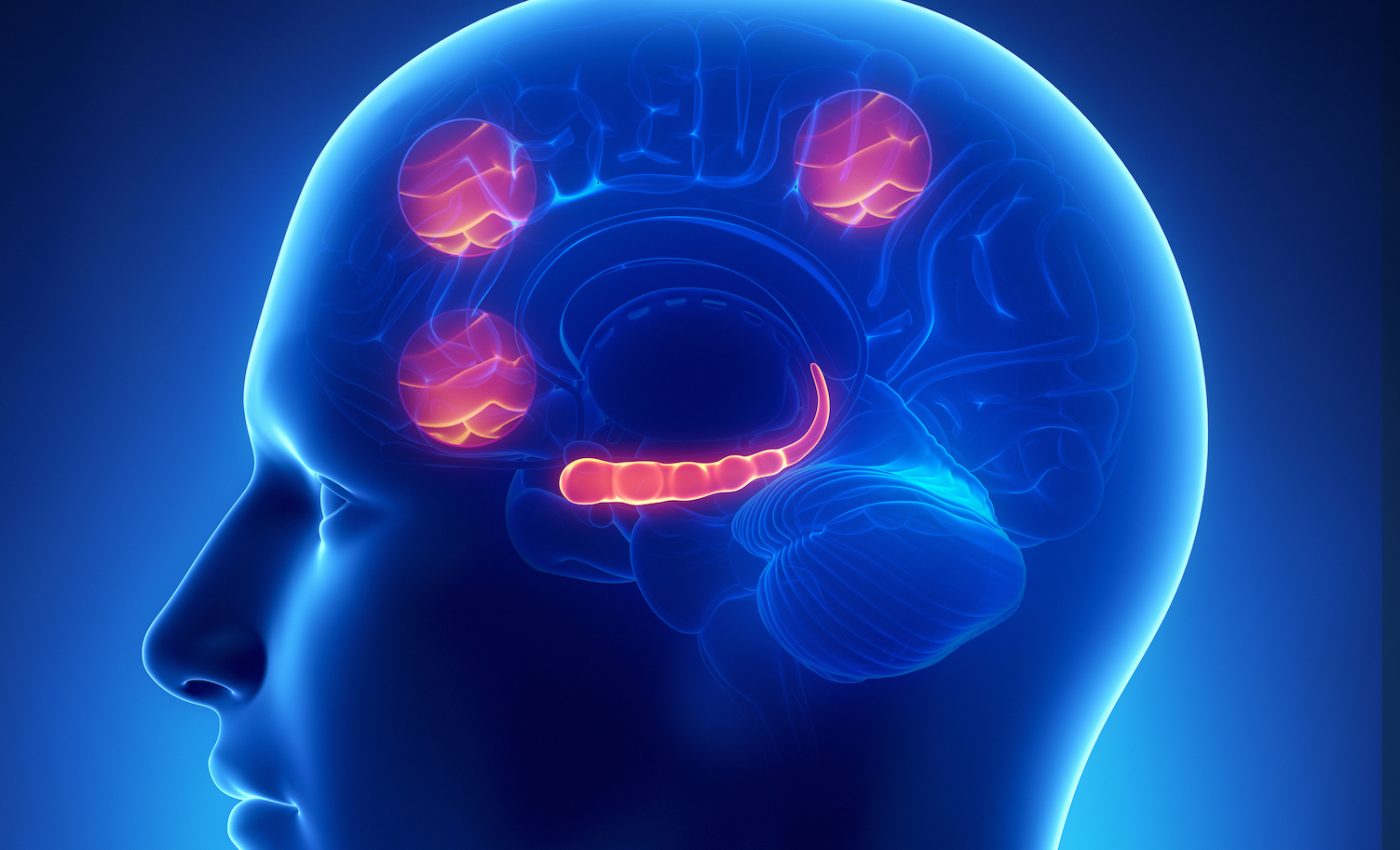 Damage to the prefrontal cortex of the brain may cause anxiety disorders