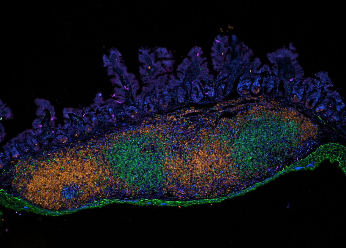 Turning back the block on the gut microbiome promotes healthier aging