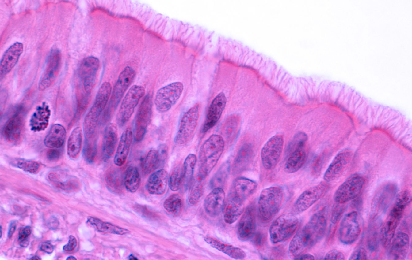 Scientists identify a molecular switch that is critical for tissue renewal