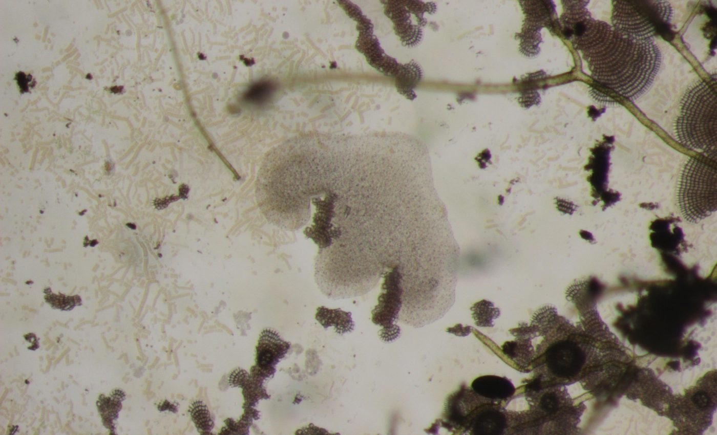 One of the simplest organisms lives in complex symbiosis with bacteria