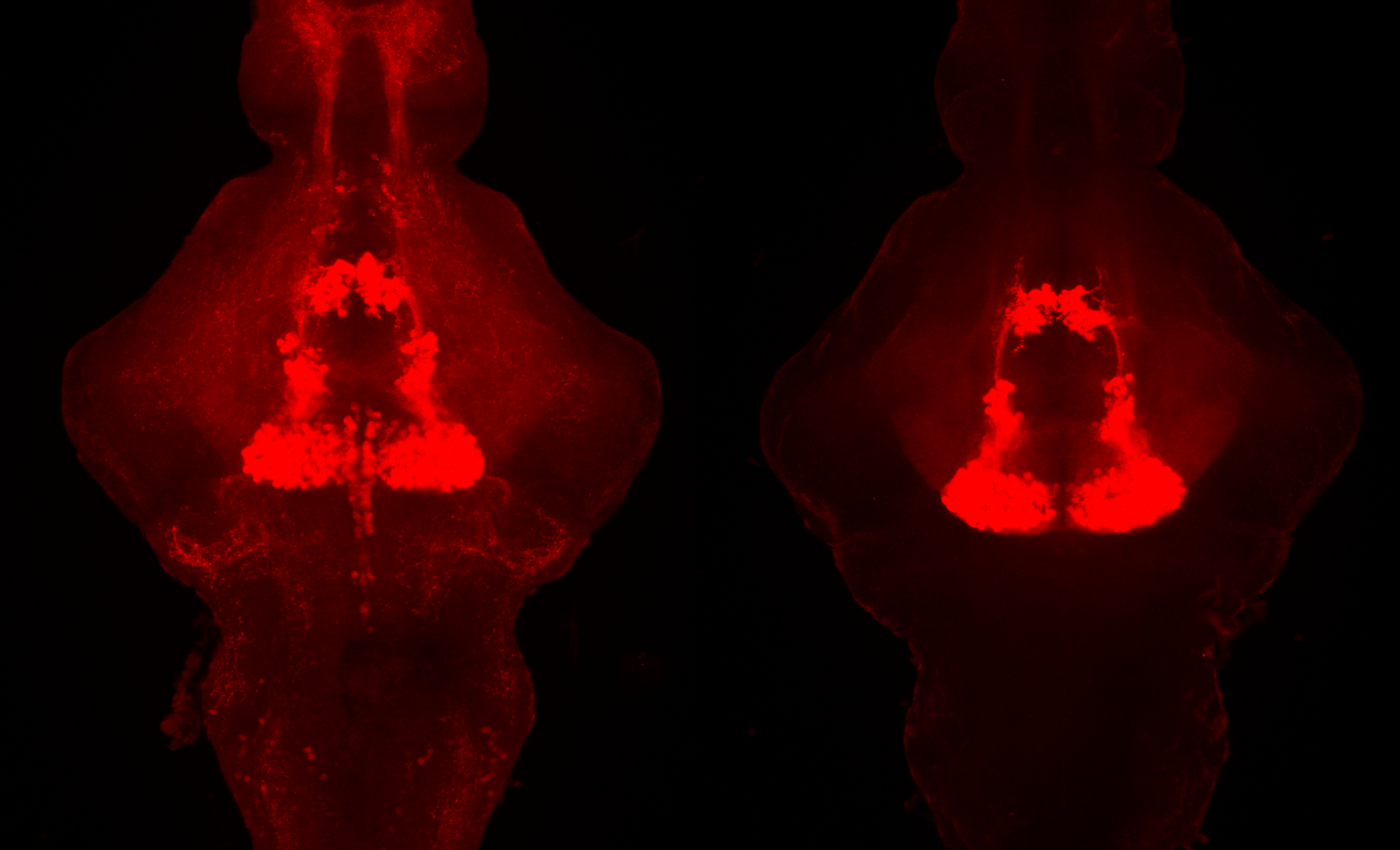 New study suggests that serotonin promotes sleep, not wakefulness