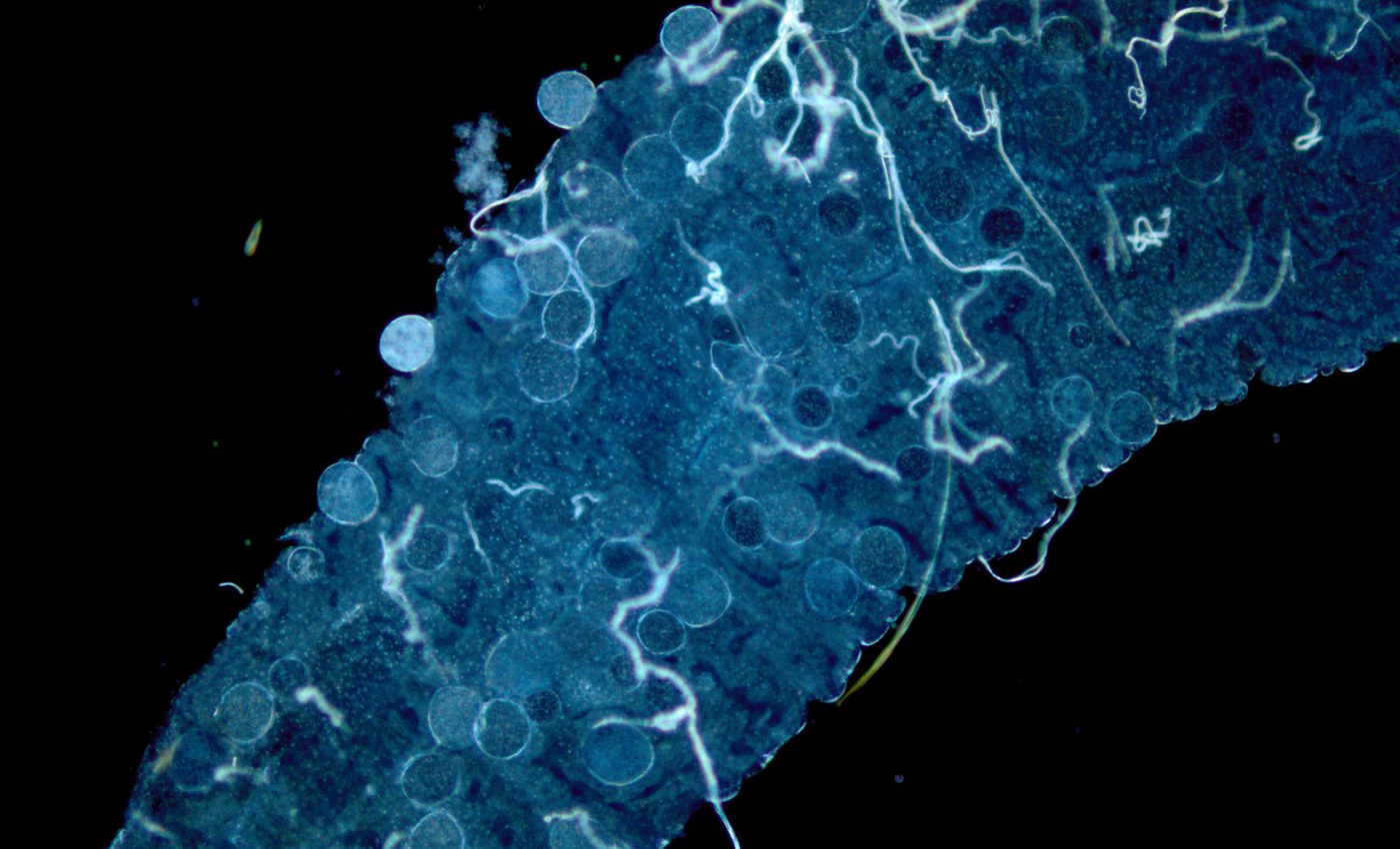 Climate change could increase the risk of malaria in colder areas