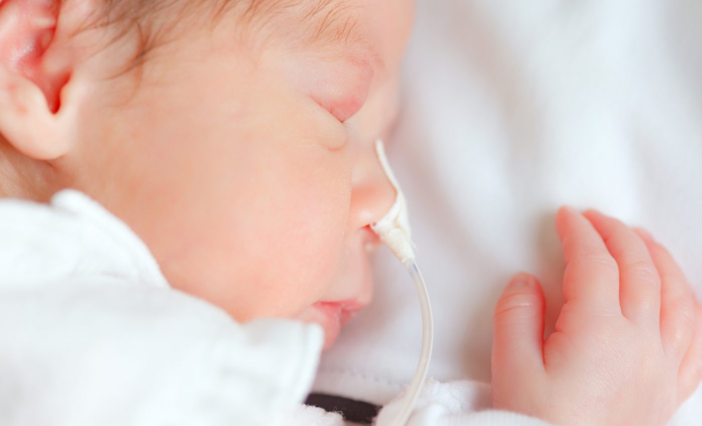 Adults who were born preterm are less likely to form romantic relationships