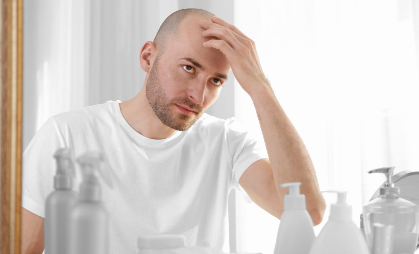 Cloning hair could offer a potential cure for baldness