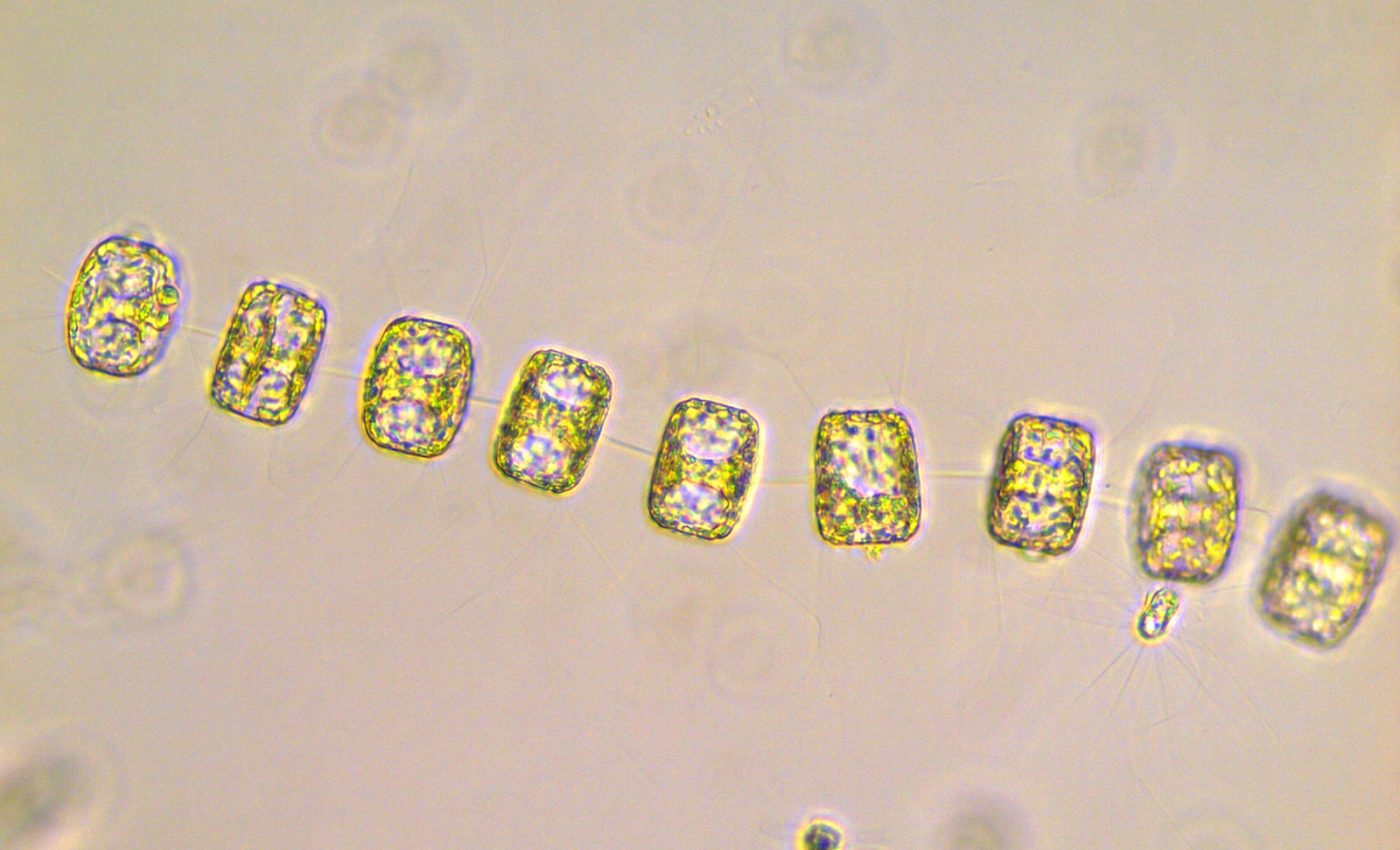 The Southern Ocean may become much less productive due to acidification