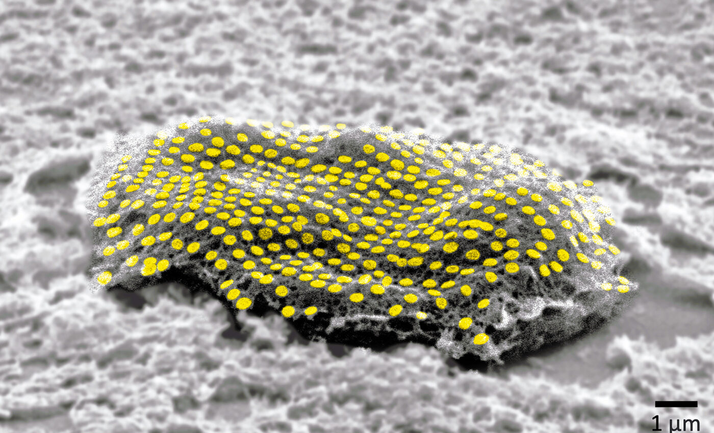 Scientists can now put nanoscale tattoos onto individual cells inside your body