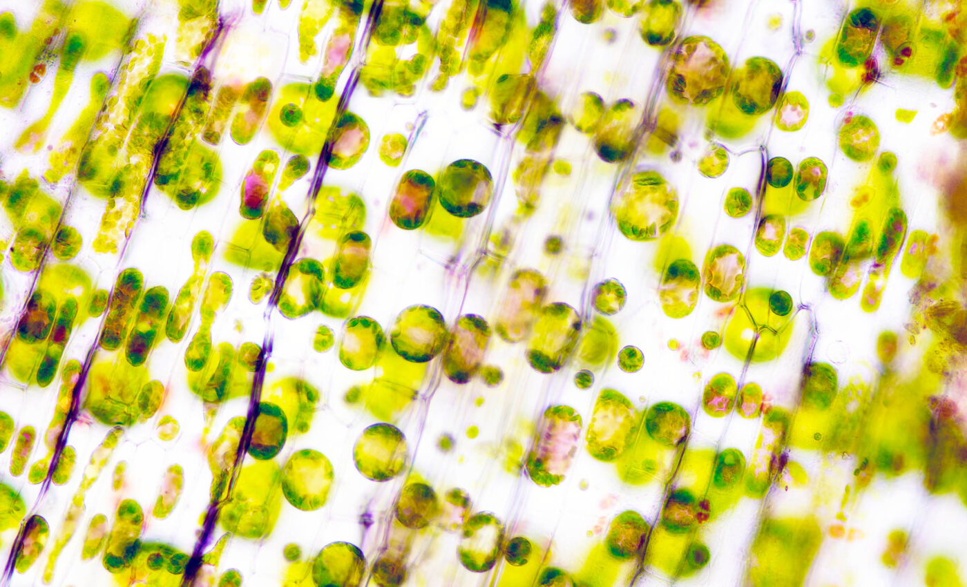 Plants have a sophisticated defense system when pathogens attack