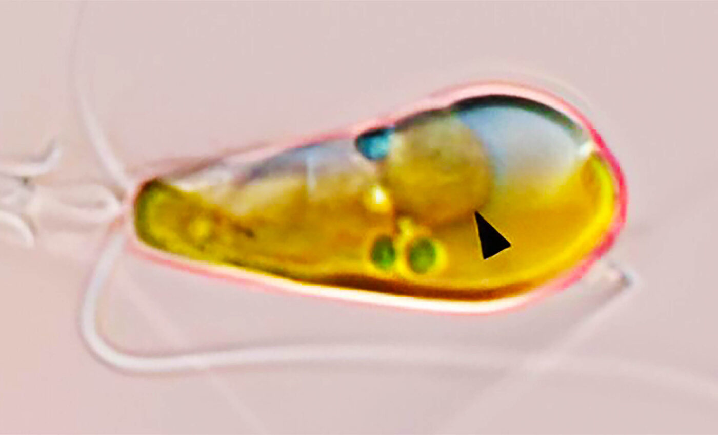 Introducing the "nitroplast" -- The first nitrogen-fixing organelle