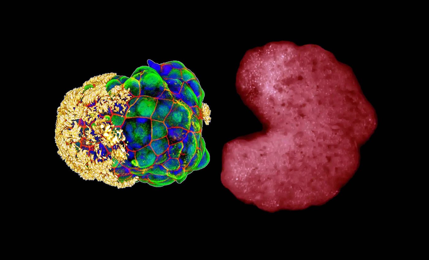 Third state" of existence