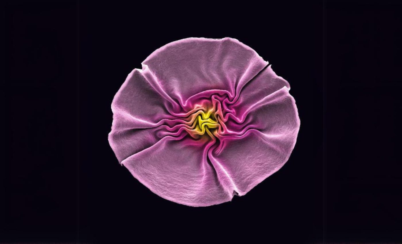 Tiny viruses link up and bloom into amazing sunflower structures