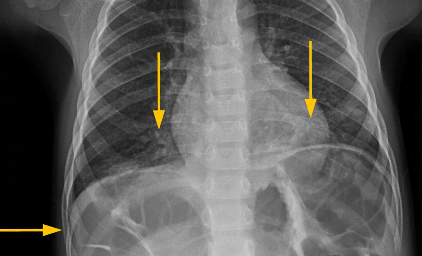 Experts say this is the best fruit to eat for a healthier liver