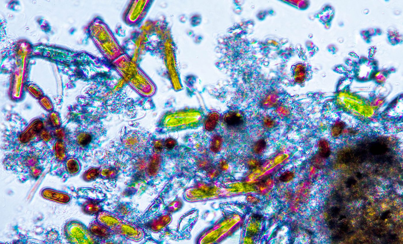 Algae that thrives on ice plays an unexpected role in glacier melting