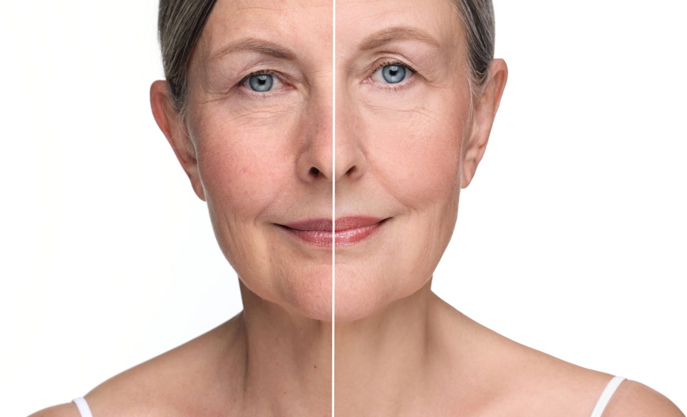 Hormones may slow skin aging and reduce wrinkles
