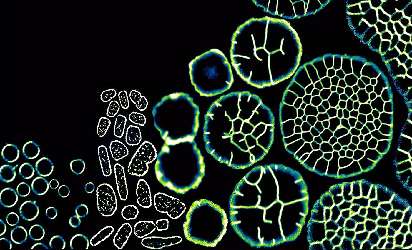 When the pressure builds, archaea go multicellular