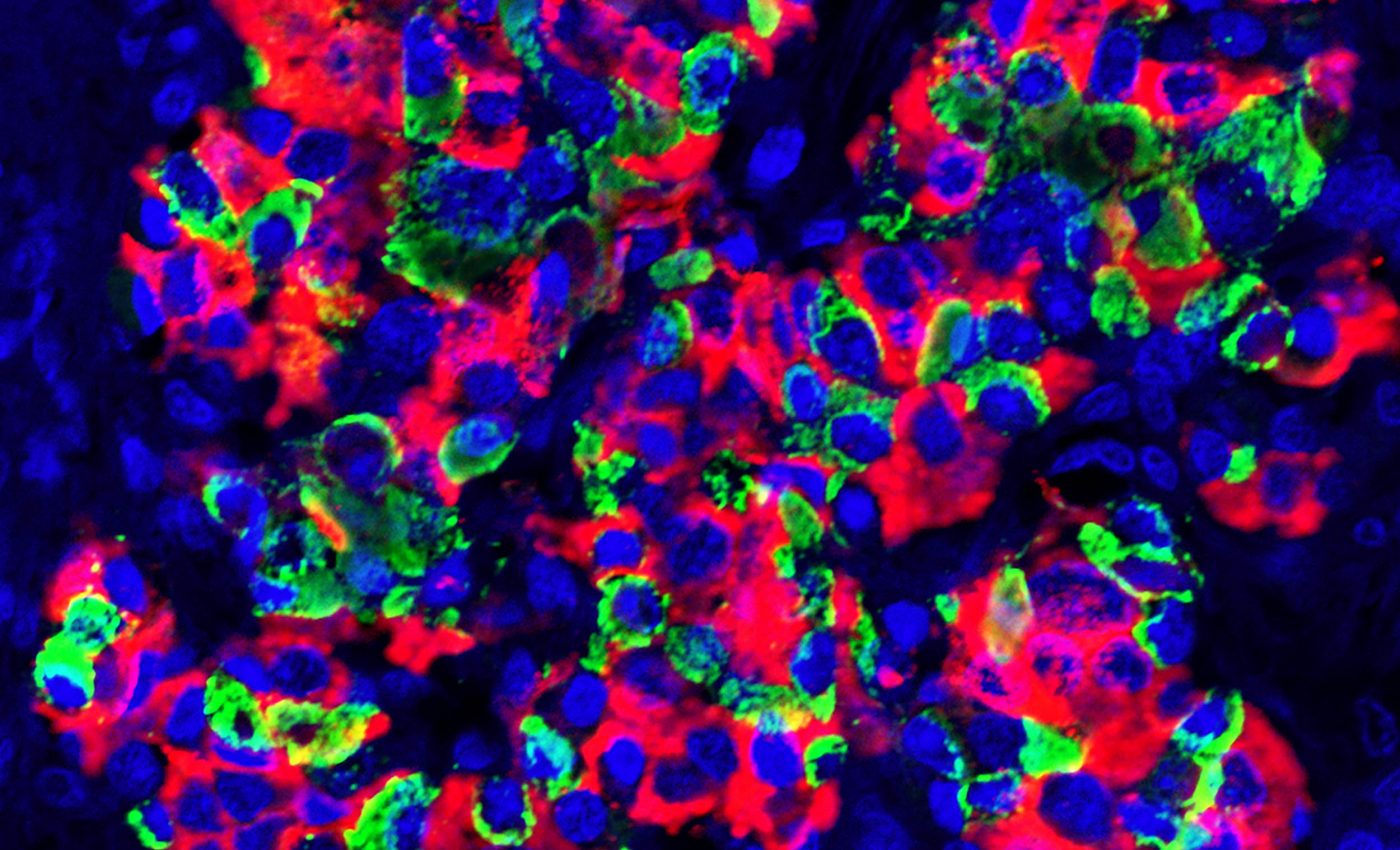 This overlooked human organ has a built-in bioreactor that could revolutionize diabetes treatment