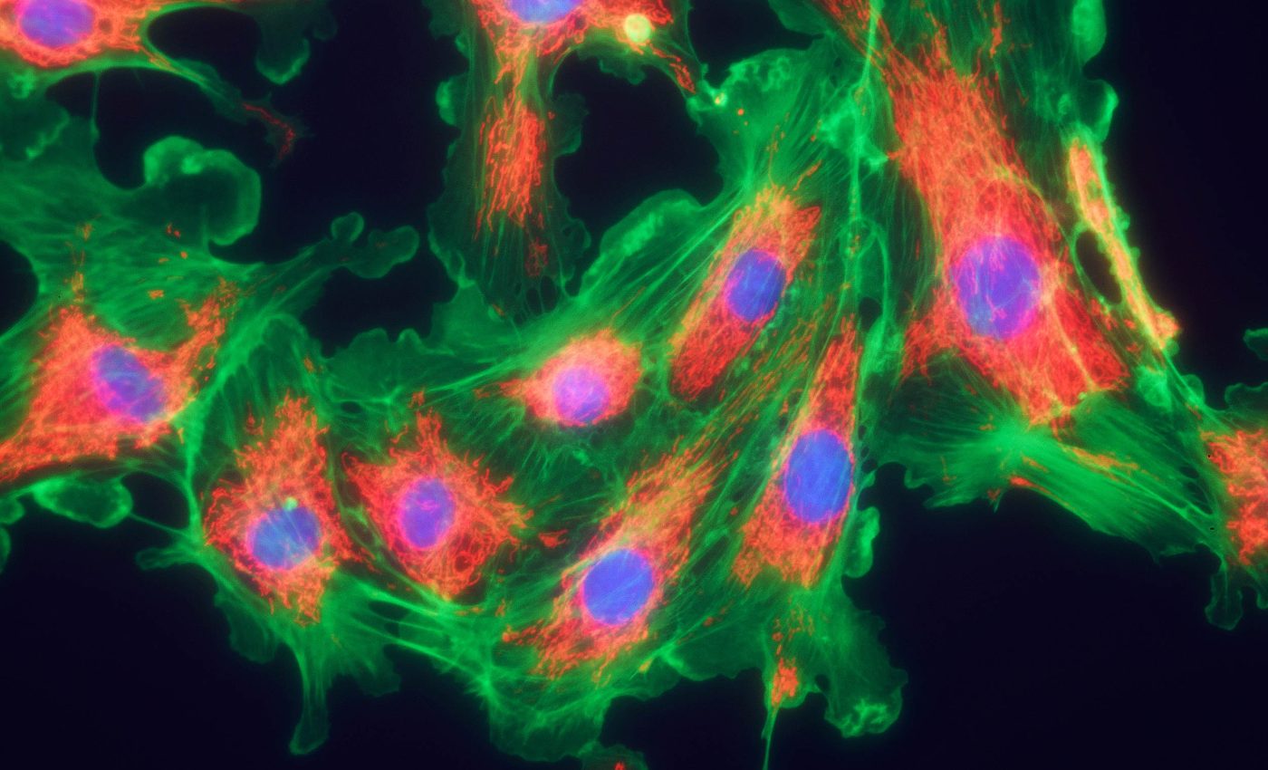 Scientists identify a cellular 'switch' that could reverse type 2 diabetes