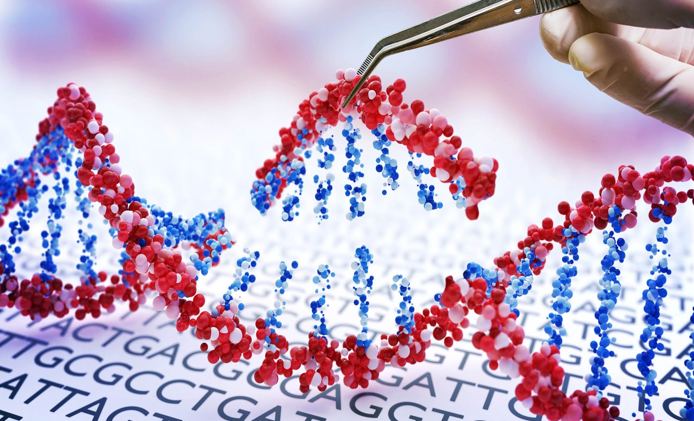 CRISPR used to remove extra chromosomes in Down syndrome and restore cell function