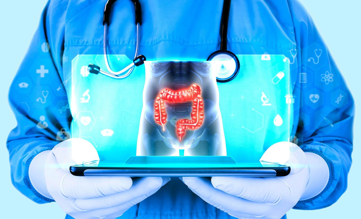 Colonoscopy vs. stool tests: Doctors found out which is better at detecting cancer