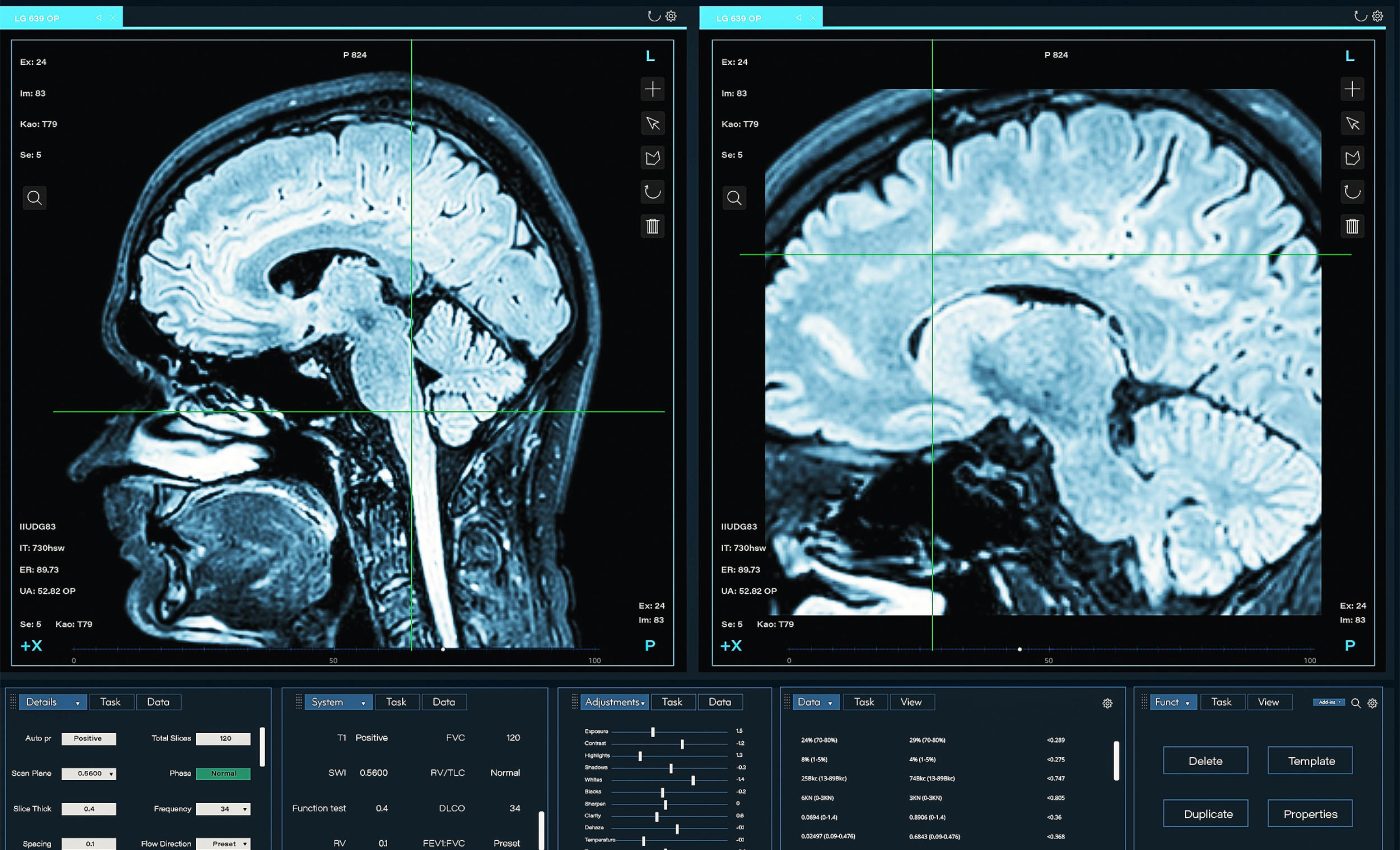 Scientists identify very specific ages when human brains lose cognitive control