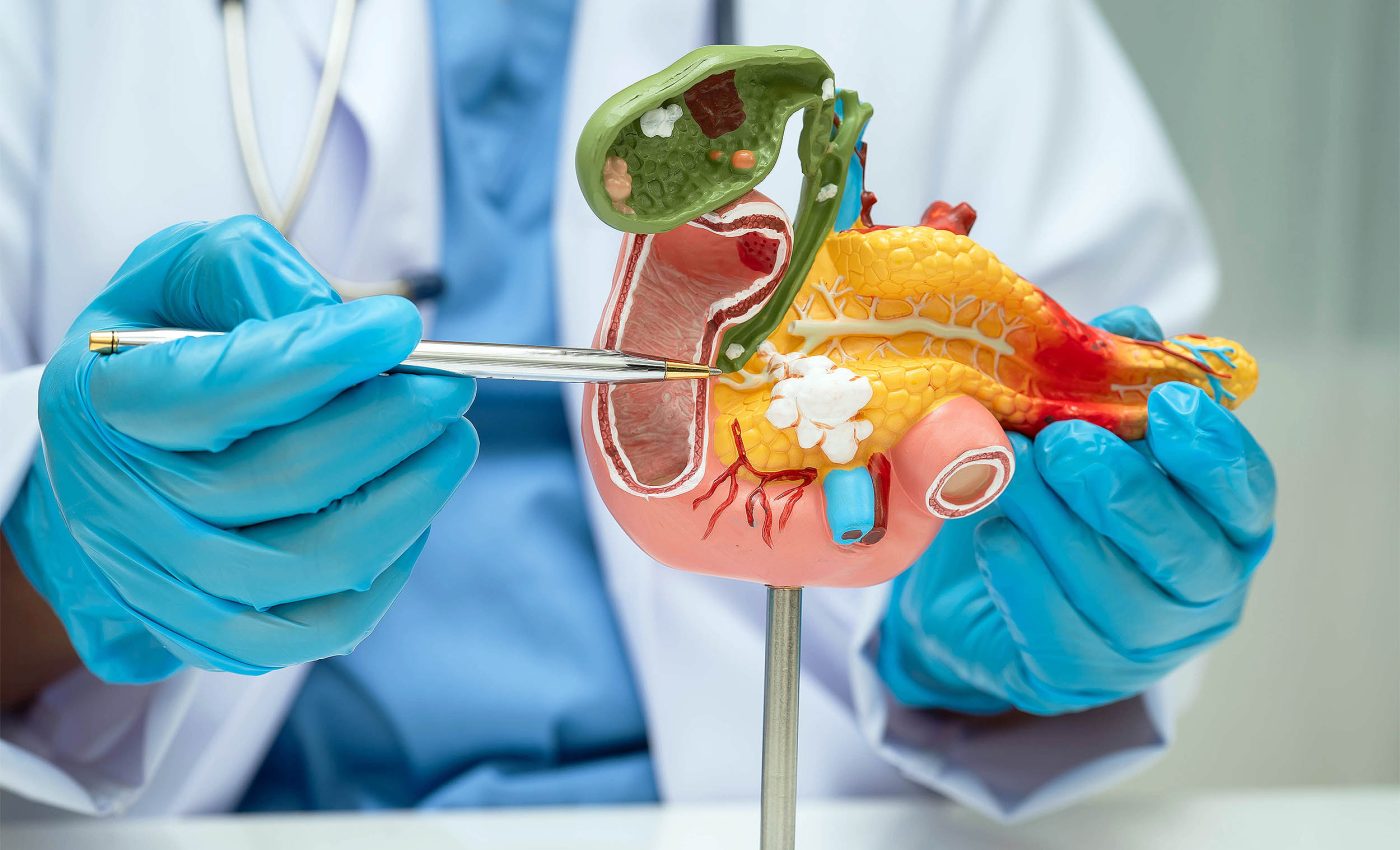 Poor oral health linked to higher risk of pancreatic cancer