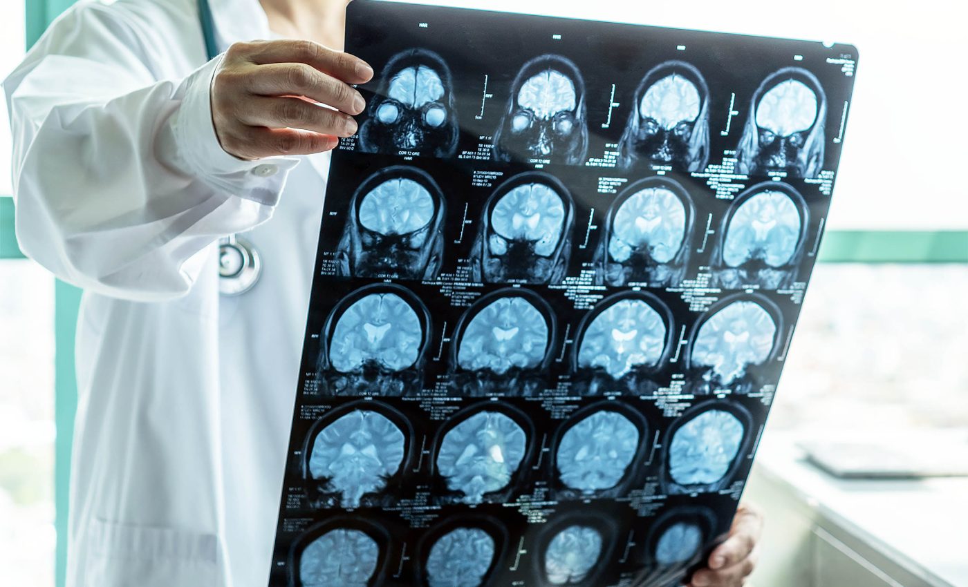 Simple habits can keep you sharp and slow brain aging