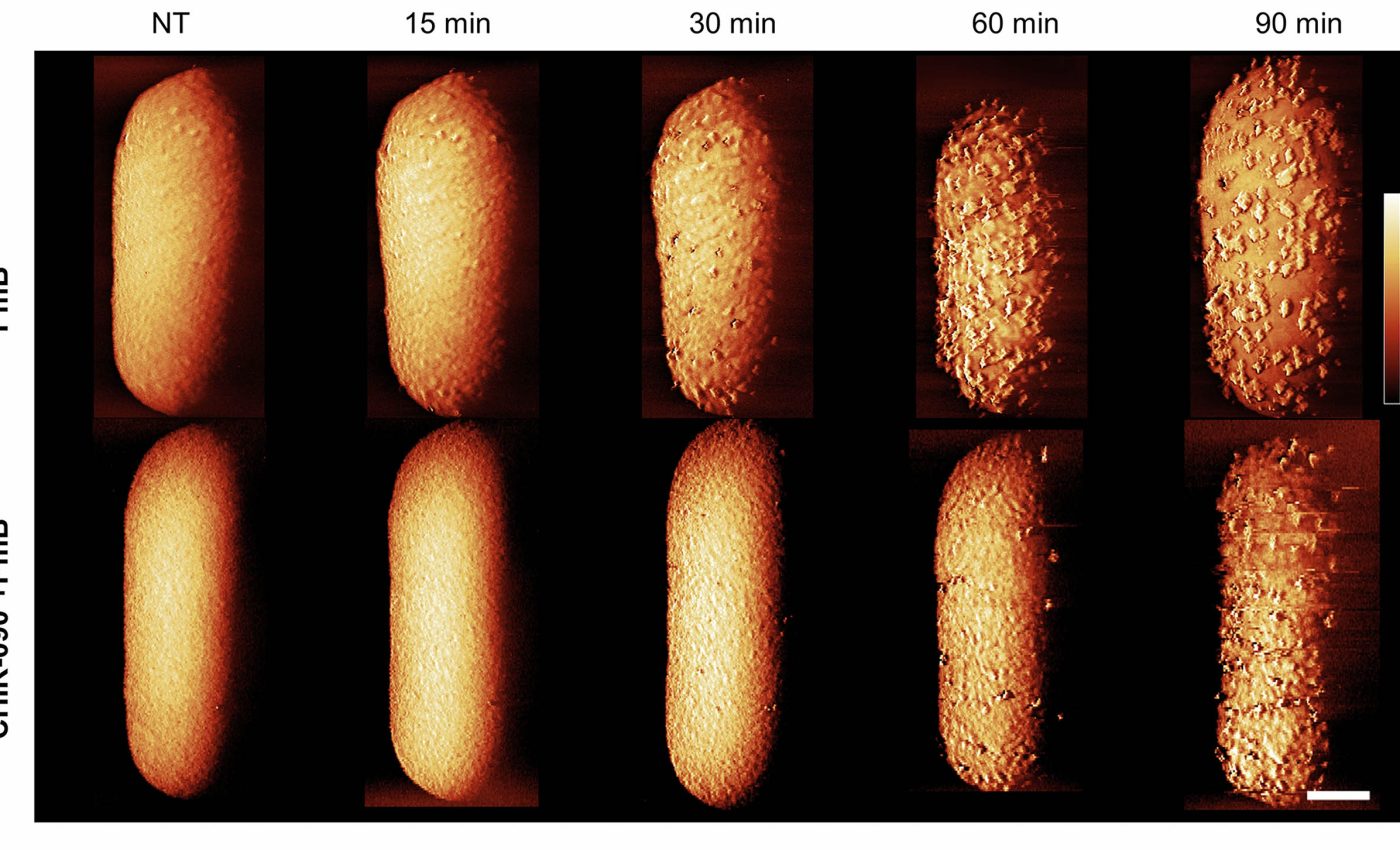 Stunning images show exactly how antibiotics destroy bacteria