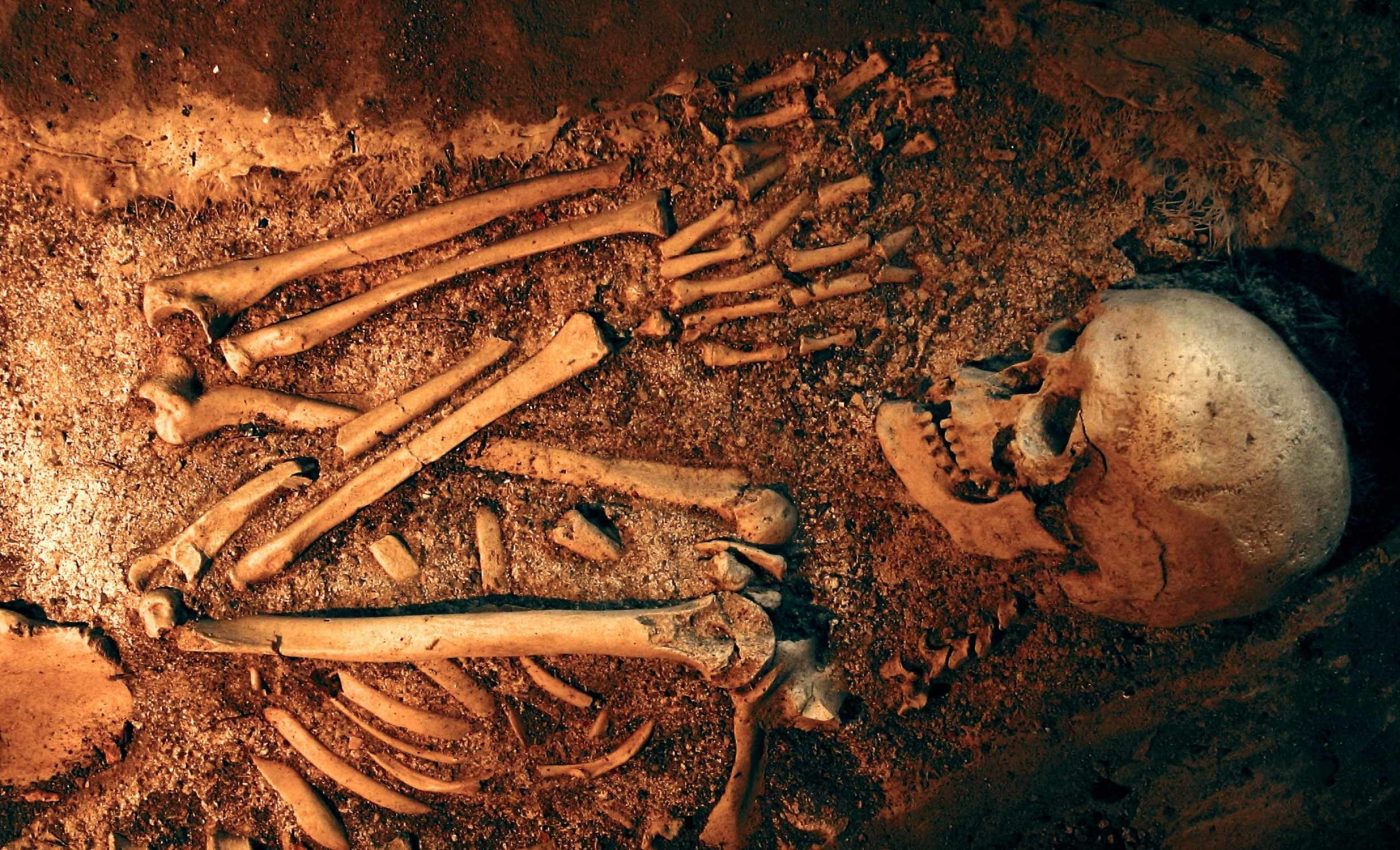 Mysterious disease that prevents people from opening their fingers comes from Neanderthals