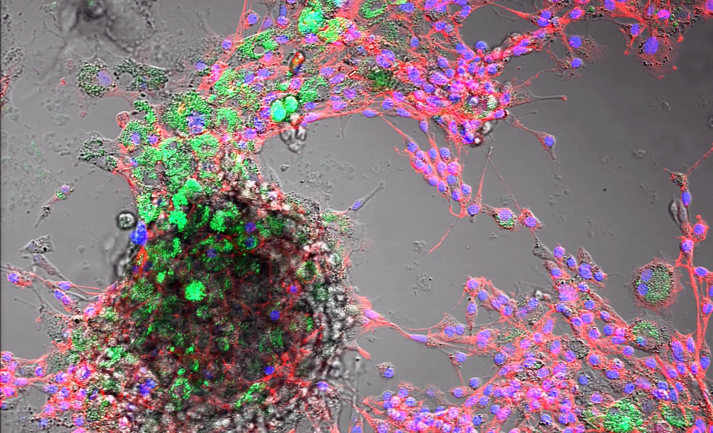 Scientists issue warning after finding nanoplastics in farm animals