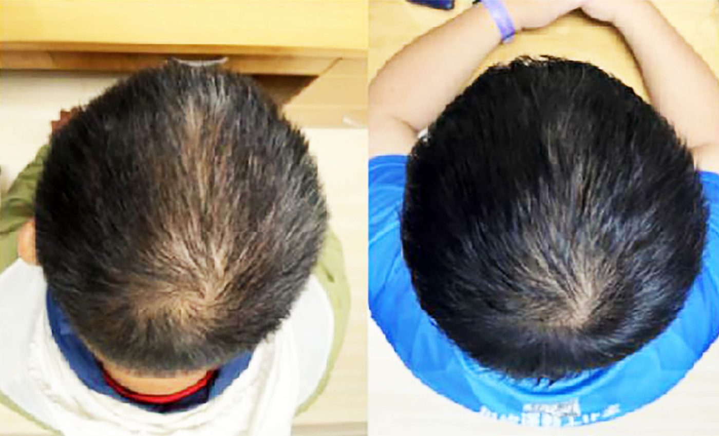 Scientists finally create a hair growth formula that actually works