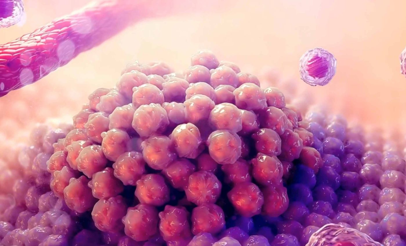 New twist boosts immunotherapy treatment in cancer patients