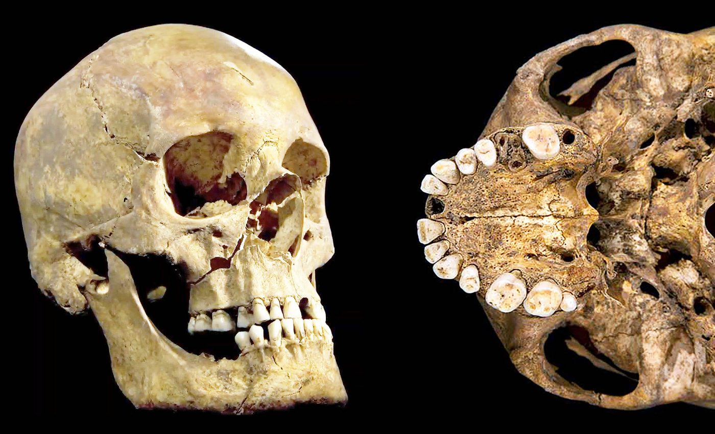 Archaeologists assemble King Richard III's microbiome using tooth plaque from 1485