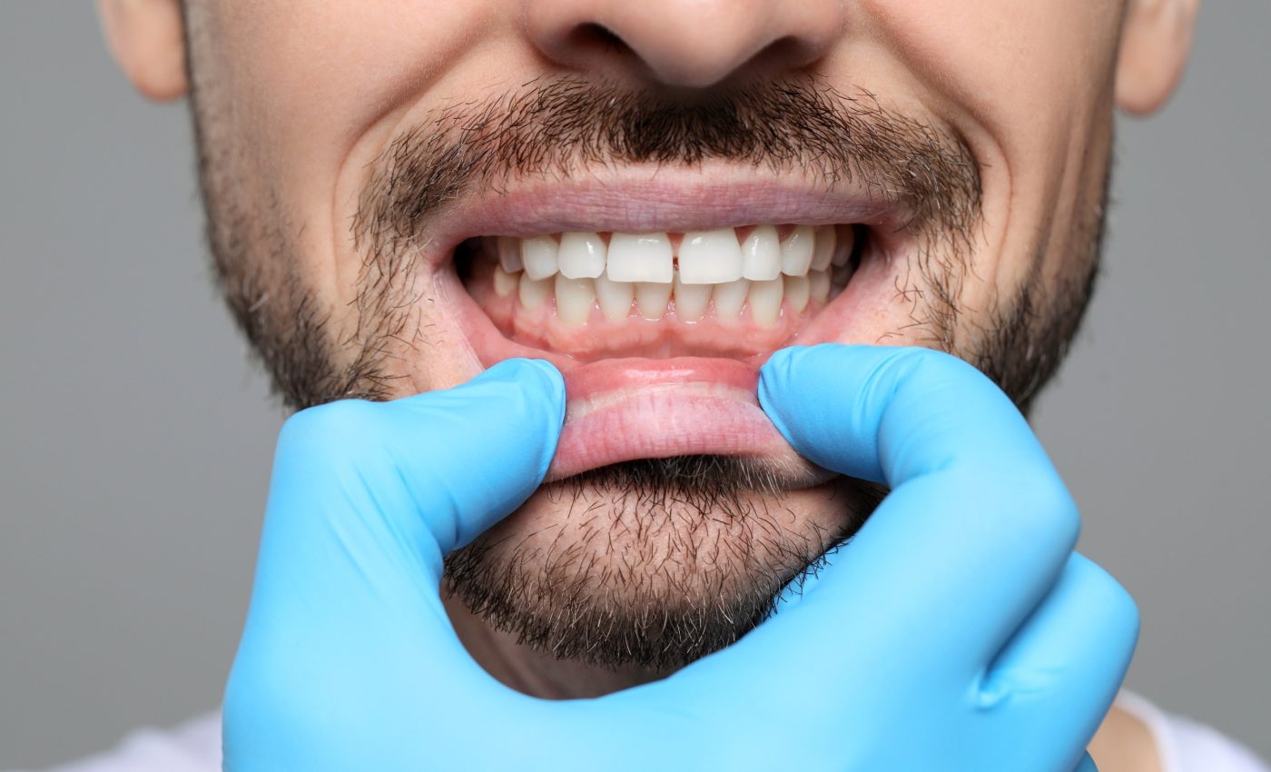 Can teeth rebuild themselves? A new gel could make it possible