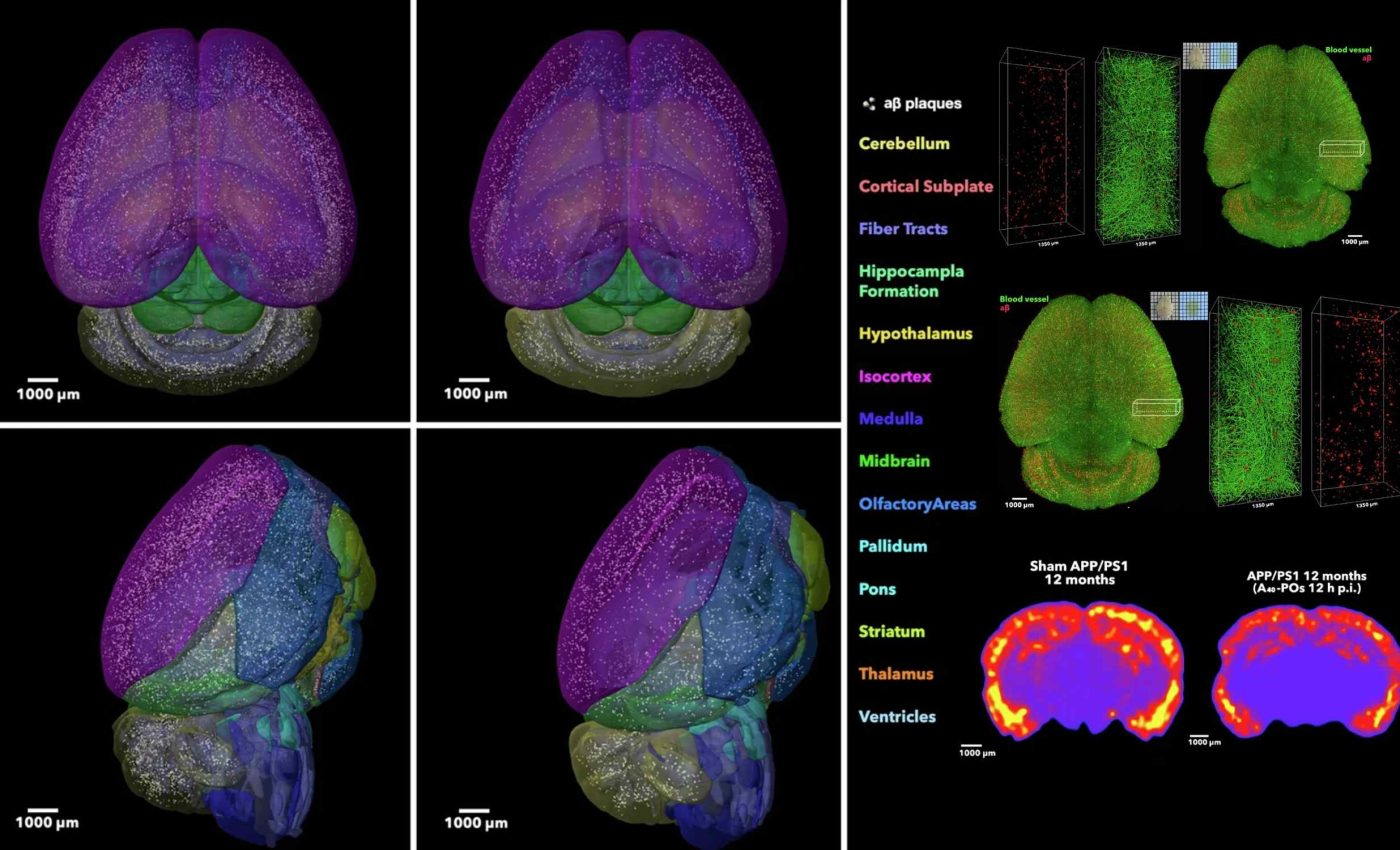 Cutting-edge nanotechnology reverses Alzheimer's disease in new study