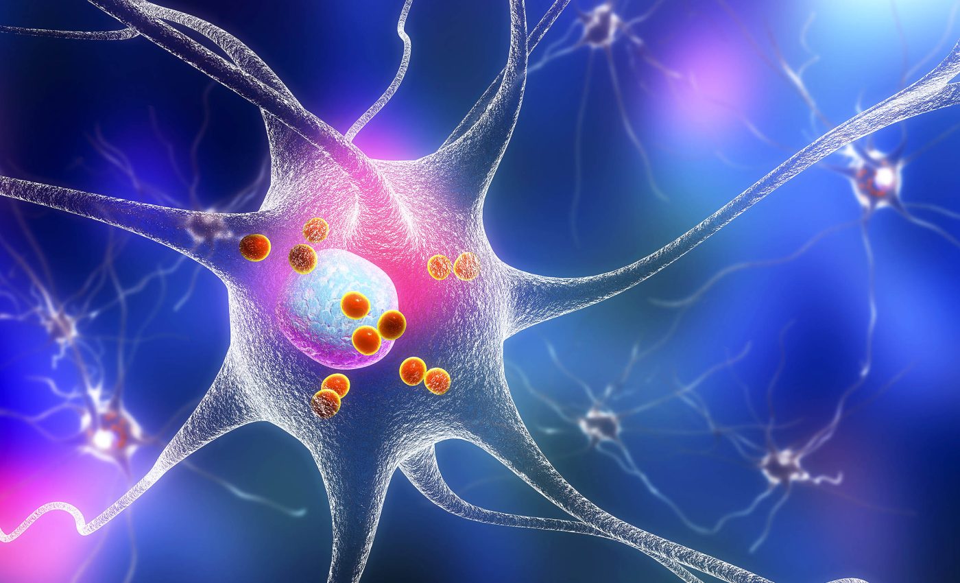 Scientists succeed in stopping the toxic protein that causes Parkinson's disease