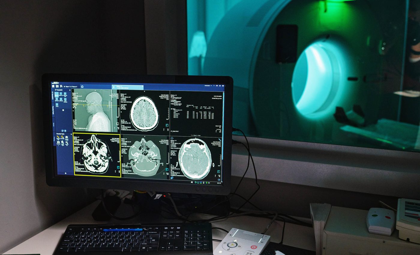 New tech called 'mind captioning' turns thoughts and mental images into simple text