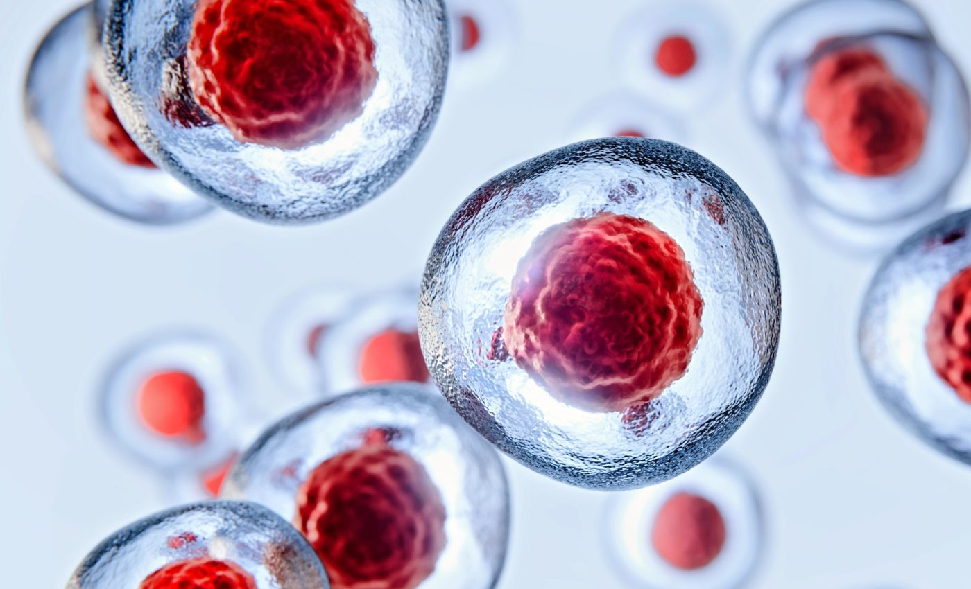 Man remains HIV-free for six years after stem cell transplant